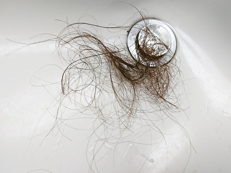 クリニック監修 1日の抜け毛は何本までが正常 多すぎる抜け毛の原因は何 薄毛 Aga治療のあれこれ Dクリニック名古屋 旧aacクリニック名古屋 の頭髪コラム